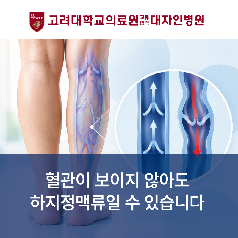 혈관이 보이지 않아도 하지정맥류일 수 있습니다ㅣ하지정맥류 증상과 진단