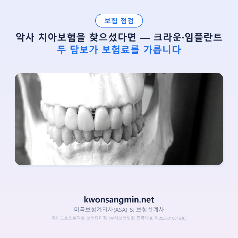 악사 치아보험을 찾으셨다면 — 크라운·임플란트 두 담보가 보험료를 가릅니다