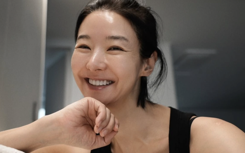 "실리프팅 지금은 싫어요" 52세 송선미 민낯 녹는 실 반복하면 피부 속이 굳는 이유