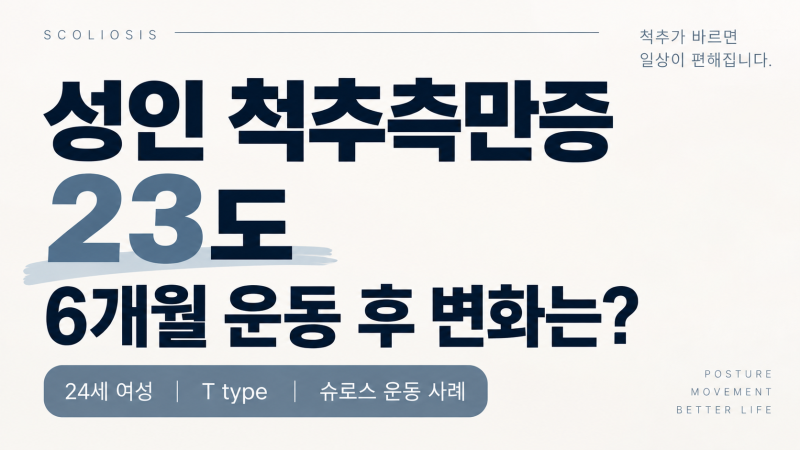성인 척추측만증 20도, 운동으로 좋아질 수 있을까요?｜24세 슈로스 운동 실제 사례