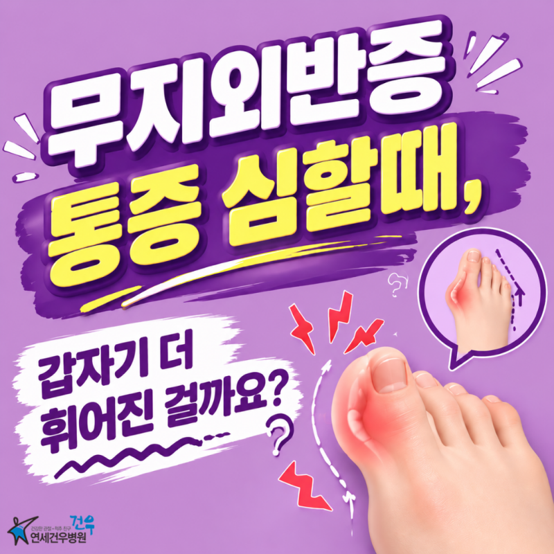 무지외반증 통증 심할때, 갑자기 더 휘어진 걸까요?