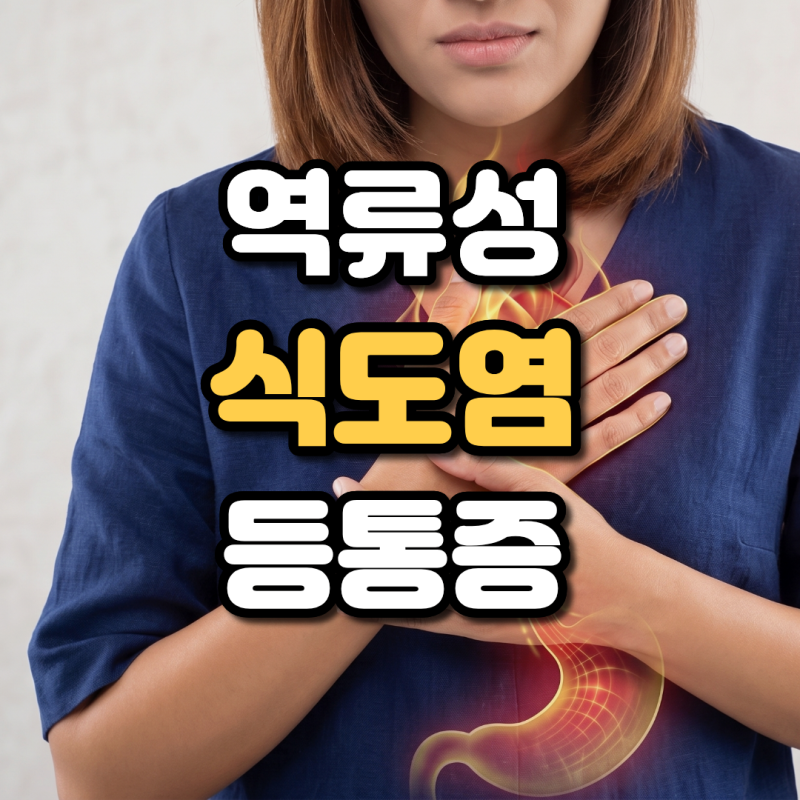 역류성 식도염 등통증 원인 명치 가슴 답답함까지 같이 나타나는 이유