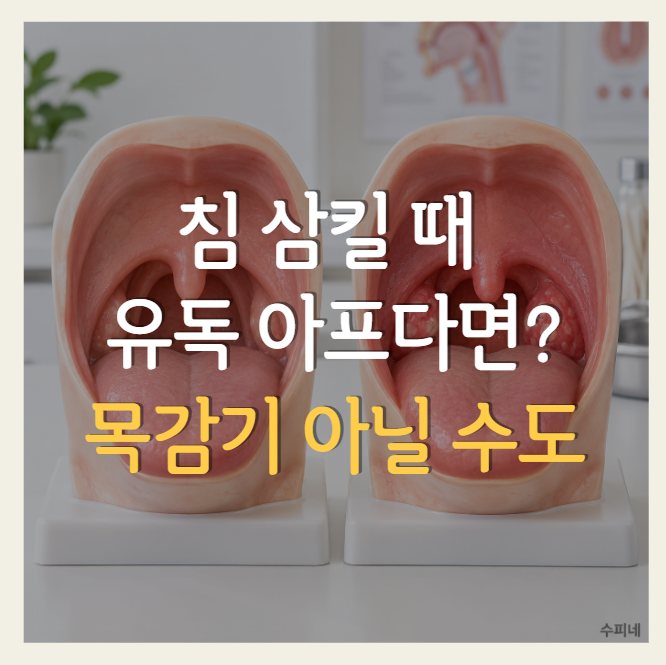 침 삼킬 때 목이 아픈 이유, 목감기와 편도염은 어떻게 다를까?
