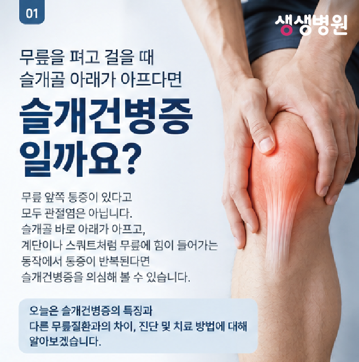 양천 정형외과 | 박범용 원장이 알려주는 무릎을 펴고 걸을 때 슬개골 아래가 아프다면 슬개....