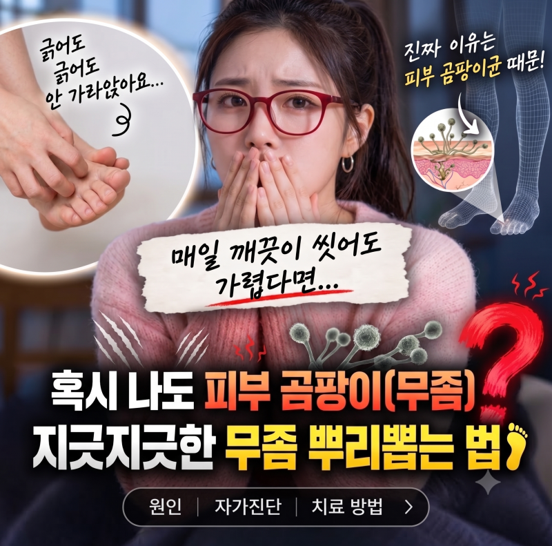 내 발도 혹시 무좀? 병원 가기 전 꼭 알아야 할 피부곰팡이의 모든 것
