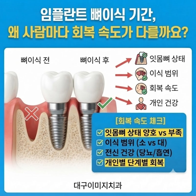 임플란트 뼈이식 기간, 왜 사람마다 회복 속도가 다를까요? | 대구 월성동 치과