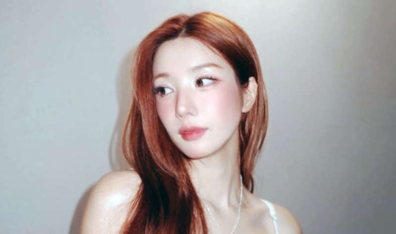 권은비 차량 접촉사고, 팬사인회 취소 소속사가 일정 멈춘 이유