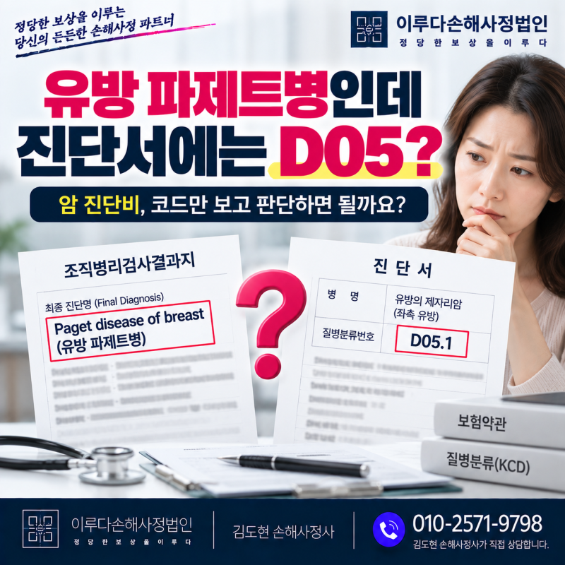 유방 파제트병 D05.1 코드로 제자리암만 지급, 일반암 인정받은 사례