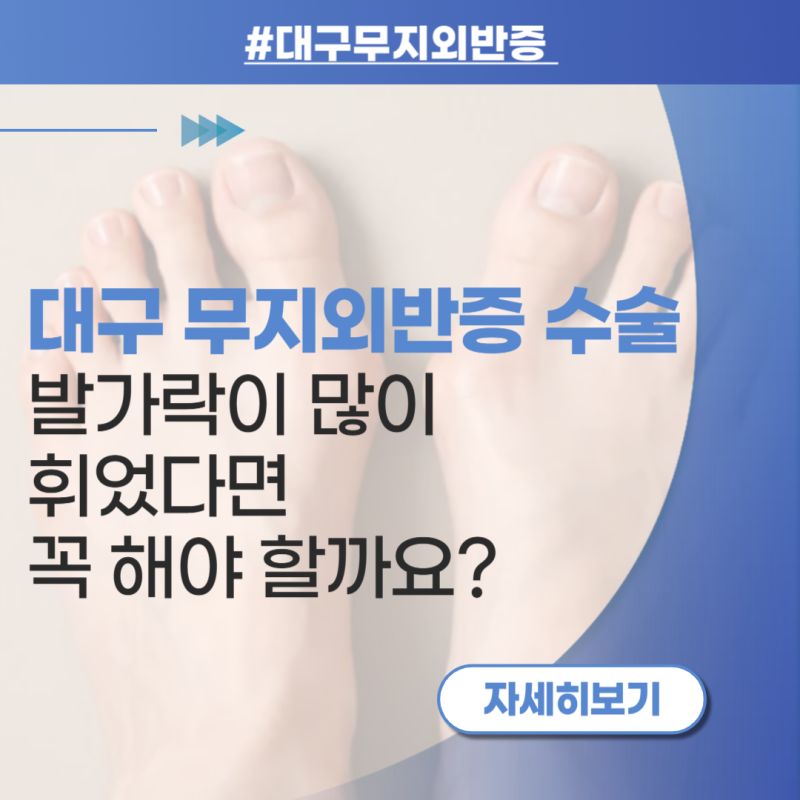대구 무지외반증 수술 발가락이 많이 휘었다면 꼭 해야 할까요?