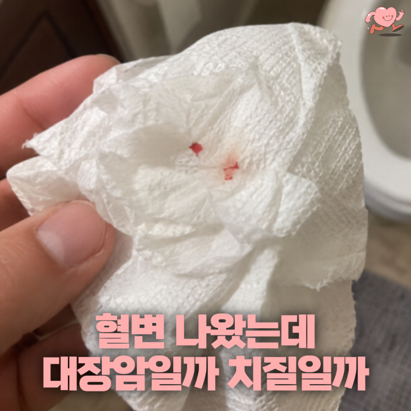 “휴지에 피가 묻었어요” 치질인 줄 알았는데 대장암도 이럴까?