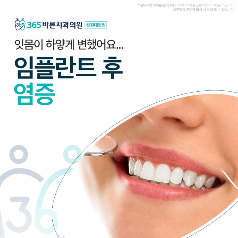 임플란트 후 잇몸이 하얗게 변했어요, 염증일까요?