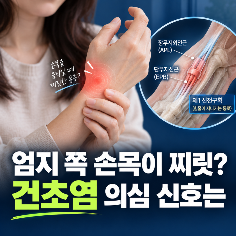 “이 동작 하나로 알 수 있다고?” 손목 건초염 증상 확인법