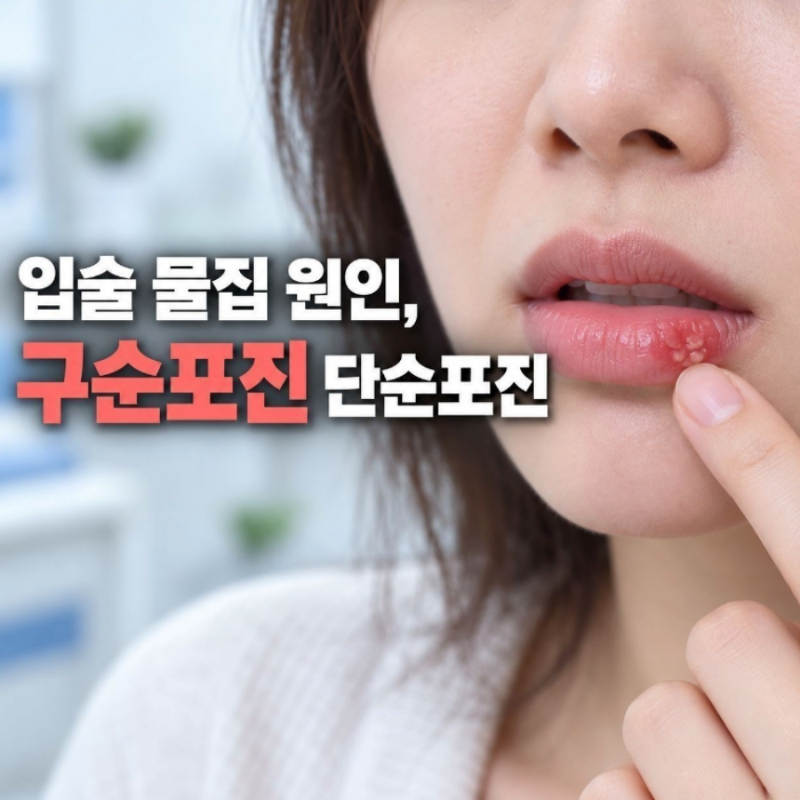 입술 물집 원인 구순포진 단순포진 입술 헤르페스 증상