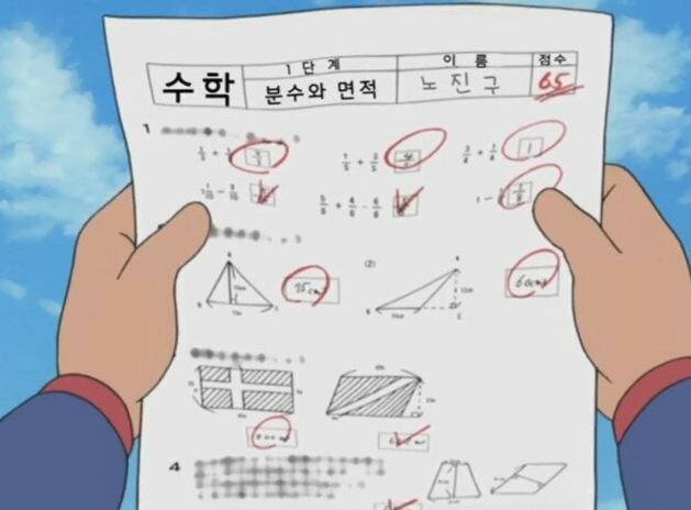 시력 1.0인데 이미 마이너스입니다