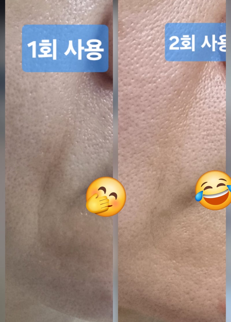 1주 사용후기, 홍현희가 광고하는 '발란스핏 EMS 조각튠 괄사 마사지기'