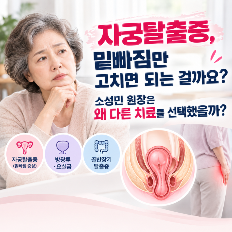 자궁탈출증, “밑빠짐만 고치면 되는 걸까요?” 소성민 원장은 왜 다른 치료를 선택했을까?