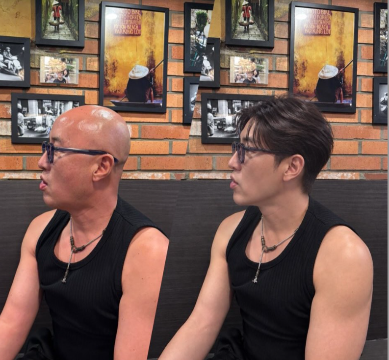 “홍석천, 머리에 털났다, 세상에 이런 일이?"