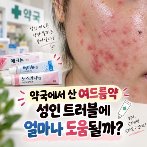 약국에서 산 여드름약 성인 트러블에 얼마나 도움될까?