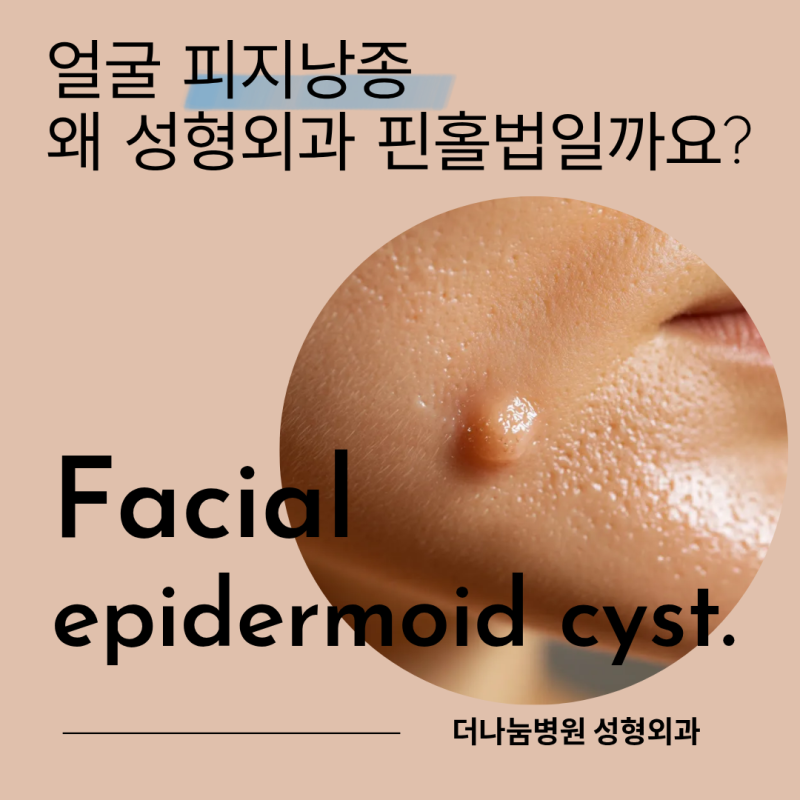 인천 성형외과 피지낭종 표피낭종, 얼굴 표피낭종 왜 성형외과에서 핀홀법으로 제거할까요?
