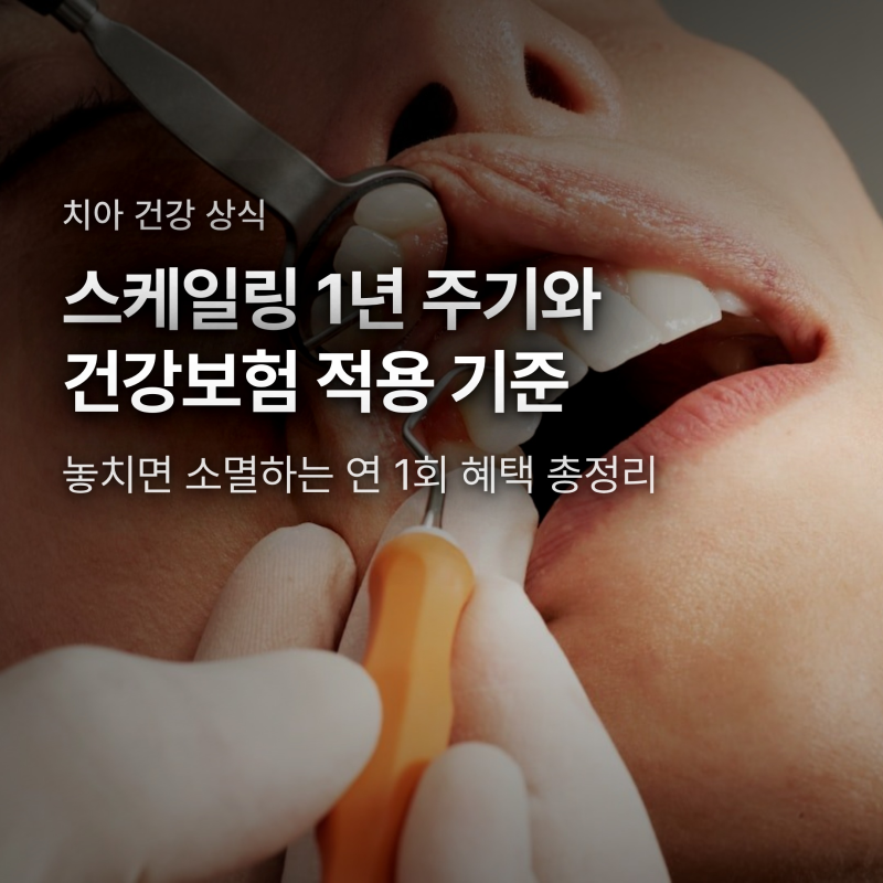 스케일링 건강보험 주기와 비용, 1년에 몇 번 받아야 할까?