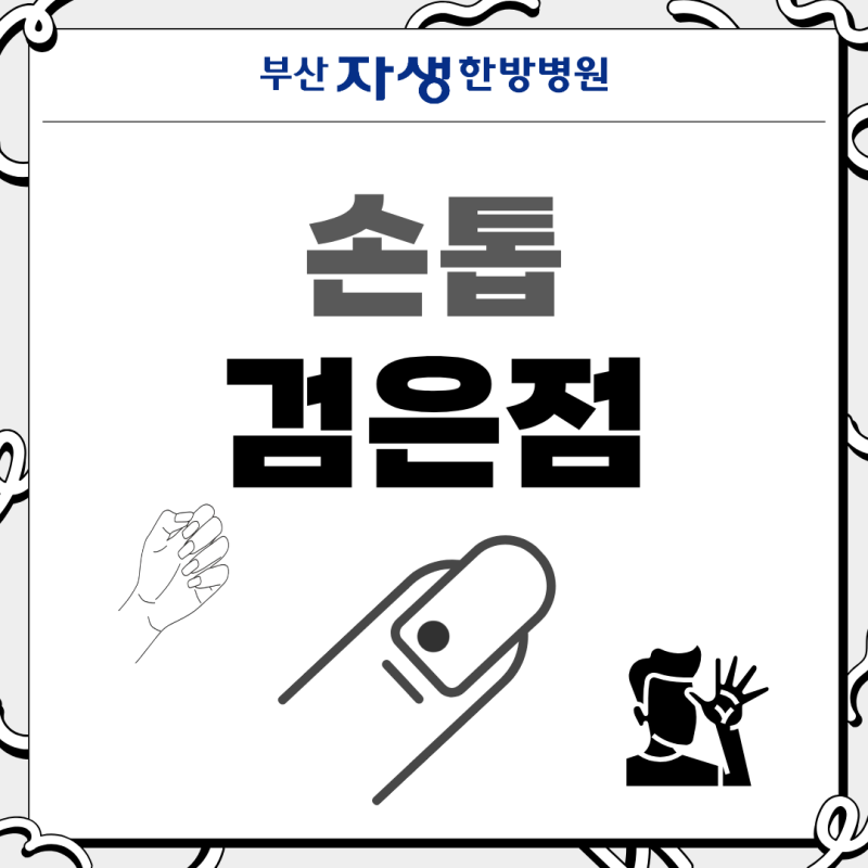 손톱 검은점, 멍일까? 조갑하 흑색종과 감별하려면?