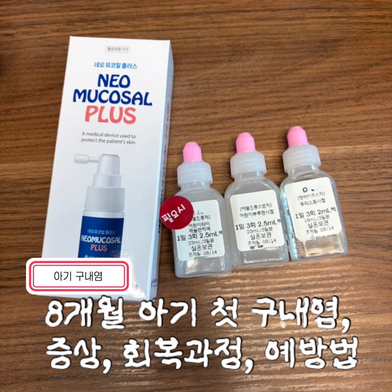 8개월 아기 첫 구내염, 감기 회복 후기 | 구내염 증상, 회복과정, 예방법