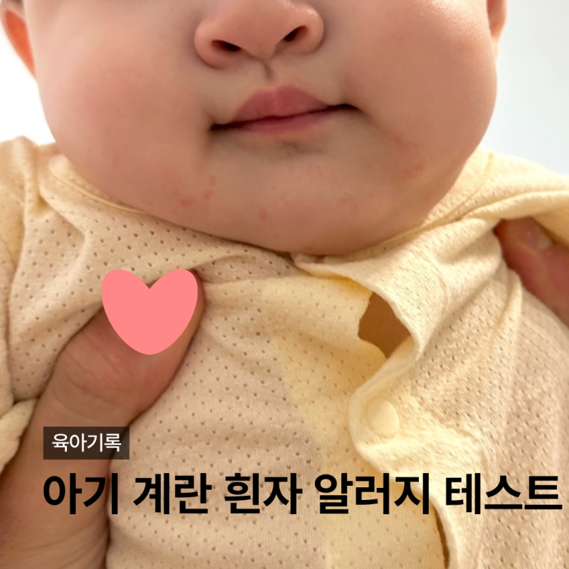 아기 계란 흰자 알러지테스트 침독일까 피부염일까 경험담