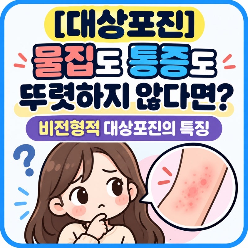 [대상포진] 물집도 통증도 뚜렷하지 않다면? 비전형적 대상포진의 특징