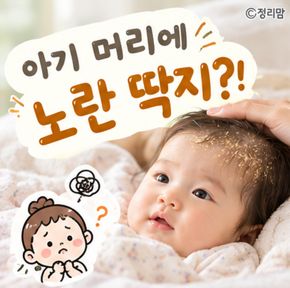 [육아 건강] 아기 신생아 지루성 두피염(두피 노란 딱지) 원인과 실전 케어 노하우