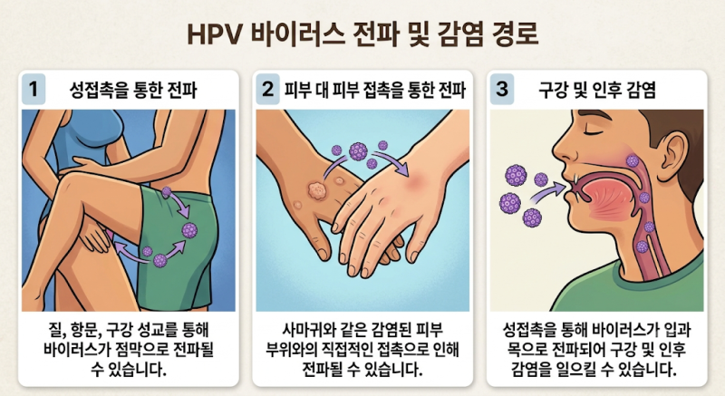 HPV 바이러스의 원인이 되는 요인