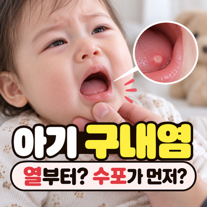 “열나고 밥까지 거부해요…” 아기 구내염 증상, 수포·혀부터 나타나는 순서는?