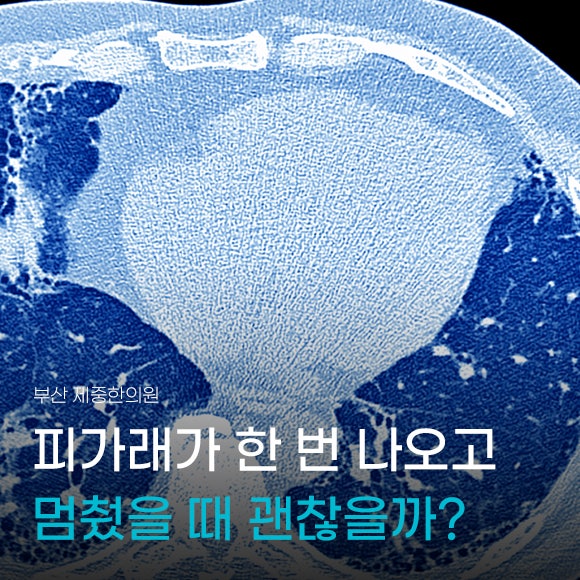 피가래가 한 번 나오고 멈췄다면 괜찮을까?
