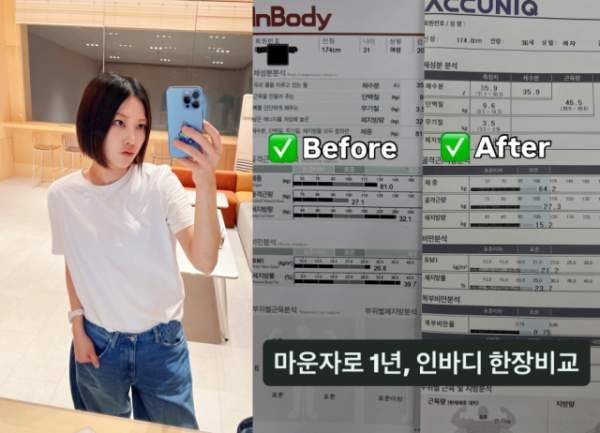 씬님, 마운자로 투약 1년…"82kg→64kg, 운동 안 했는데 근육은 그대로"