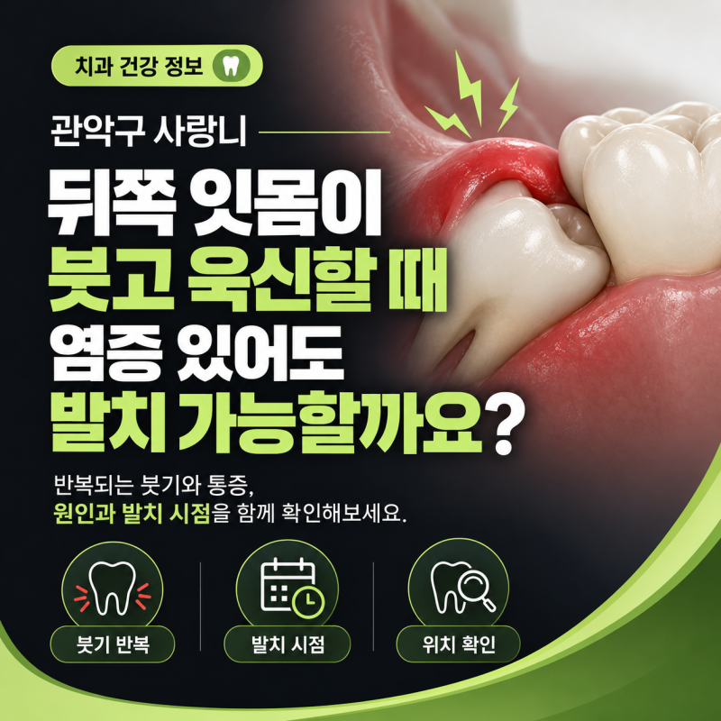 관악구사랑니 잇몸이 붓고 욱신거릴 때 염증이 있어도 발치할 수 있을까요?