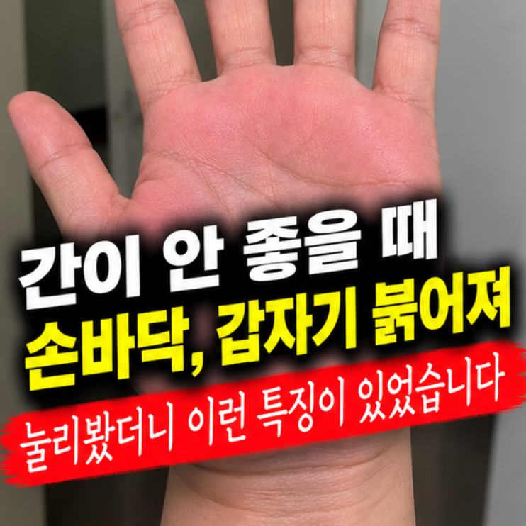 간이 안 좋을 때 손바닥, 갑자기 붉어져 눌러봤더니 이런 특징이 있었습니다