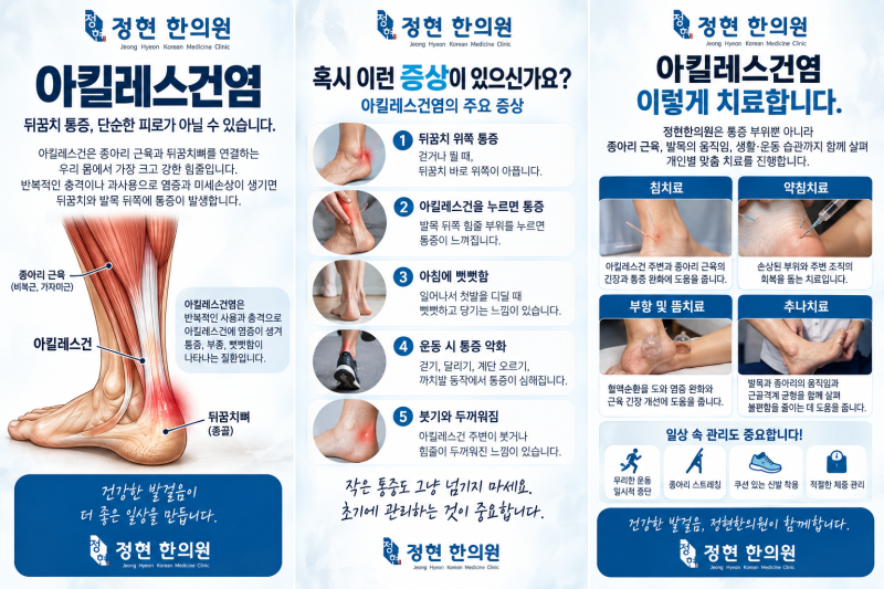 [동작구상도동숭실대역1번출구바로앞정현한의원] 아킬레스건염, 뒤꿈치가 아프고 걸을 때 ....