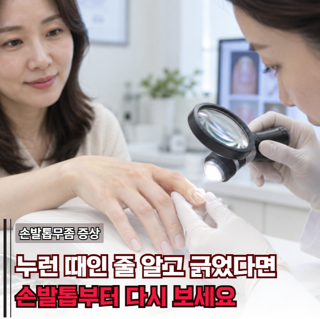 "때가 꼈나?" 계속 긁어냈다면? 손발톱무좀 초기증상에서 놓치기 쉬운 신호