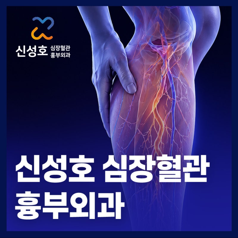 광진구 하지정맥류 병원 가기 전 필독! 증상, 검사 과정, 치료법은