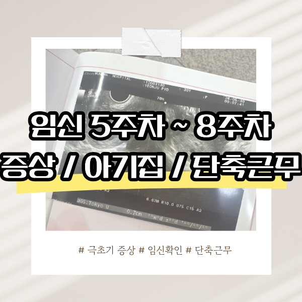 임신 5주차 ~ 8주차 증상 / 임신확인 / 단축근무