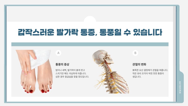 발가락이 붓고 아플 때 통풍 병의원 어디로 가야 할까요?