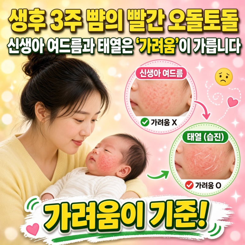 생후 3주 뺨의 빨간 오돌토돌, 신생아 여드름과 태열은 '가려움'이 가릅니다