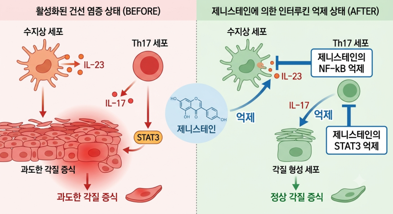 건선 치료에서 중요한 것들