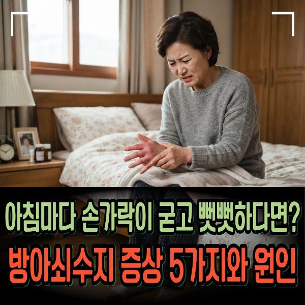 아침마다 손가락이 굳고 뻣뻣하다면? 방아쇠수지 증상 5가지와 원인