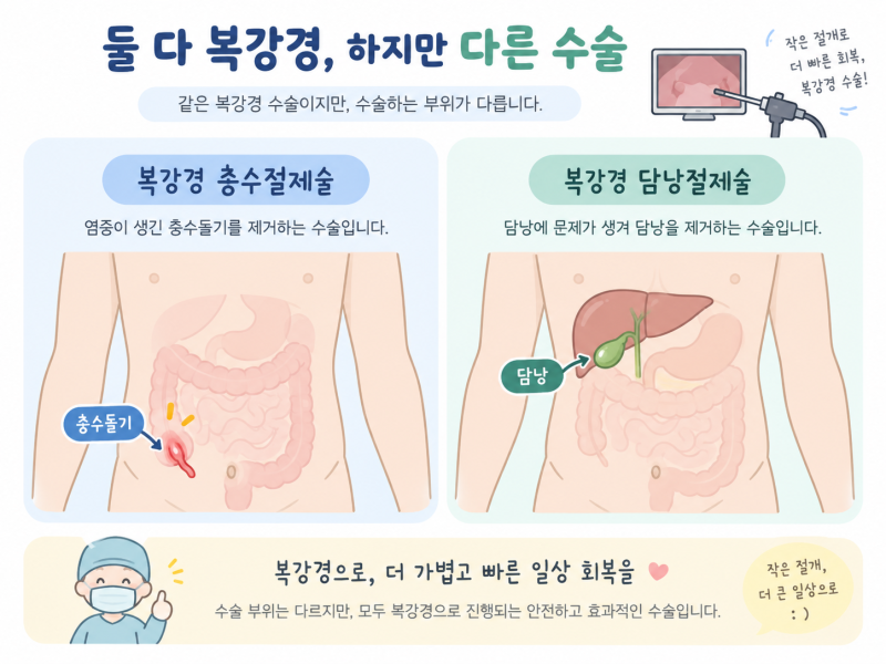 맹장수술 복강경과 담낭절제술 복강경, 같은 수술일까? 수술시간·입원기간·회복기간까지 ....