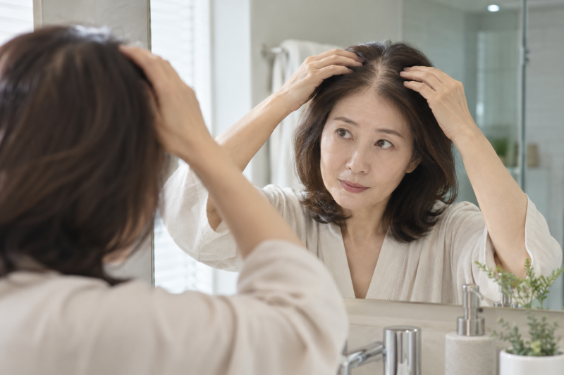 폐경기 탈모(갱년기)는 나이 탓이라 치료해도 소용없을까?