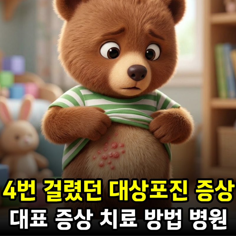 4번 걸렸던 대상포진 증상과 대표 증상, 치료 방법, 병원