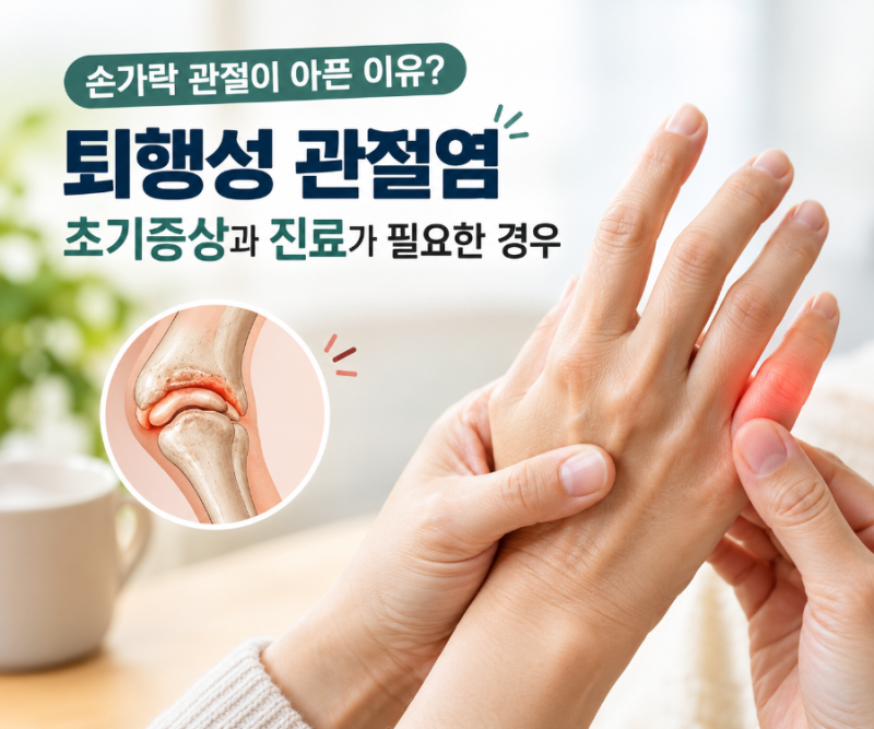 손가락 관절이 아픈 이유? 퇴행성 관절염 초기증상과 진료가 필요한 경우