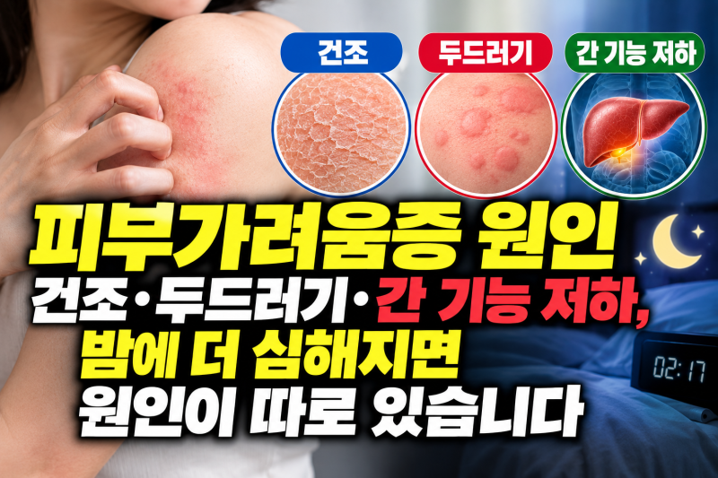 피부가려움증 원인 — 건조·두드러기·간 기능 저하, 밤에 더 심해지면 원인이 따로 있습니....