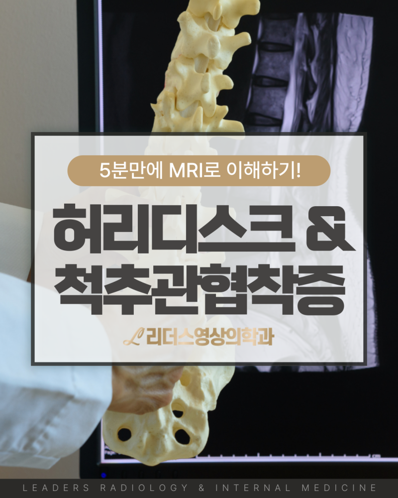 허리디스크와 척추관협착증, 왜 MRI로 확인해야 할까? 차이점과 치료 방법