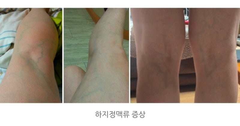도대체 내 실손보험은 몇 세대일까? 보험증권을 다시 꺼내봤습니다.4편